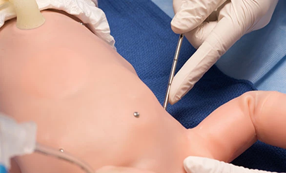 Gaumard-Super-Tory-S2220-pneumothorax Pneumothorax Eingriff an Gaumard Super Tory S2220 Neugeborenen-Simulator