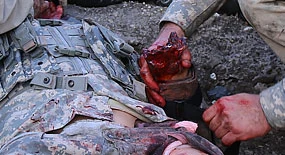 Gaumard-Trauma-HAL-S3040.50-wunde-galerie-2