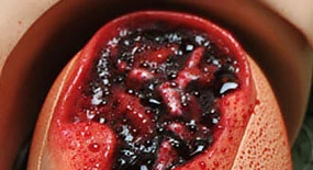 Gaumard-Trauma-HAL-S3040.50-wunde-galerie-3