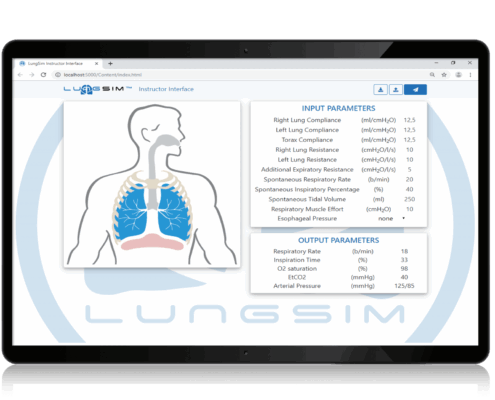 Bildschirmansicht des Accurate LungSim-Beatmungssimulator