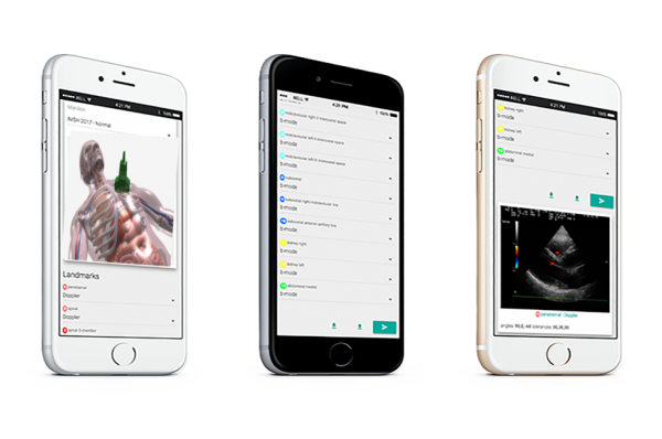 Accurate Vaussim App in der Ansicht auf drei Handyvarianten