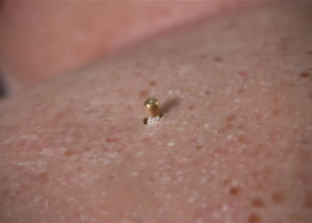 paul-overlay-03.jpg Detailaufnahme der Hautstruktur des Überzugs von Simulation Collective