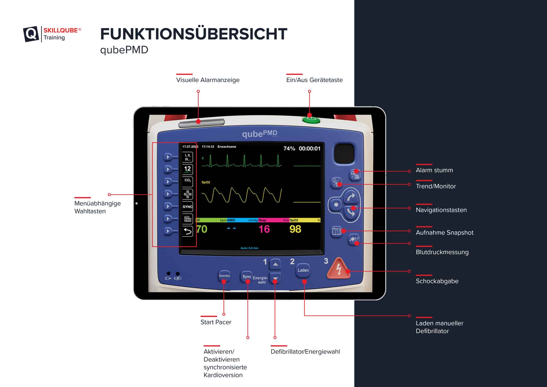 Funktionsübersicht eines EKG-Patientenmonitor Simulator als Schnittstelle zum Zoll Propaq MD