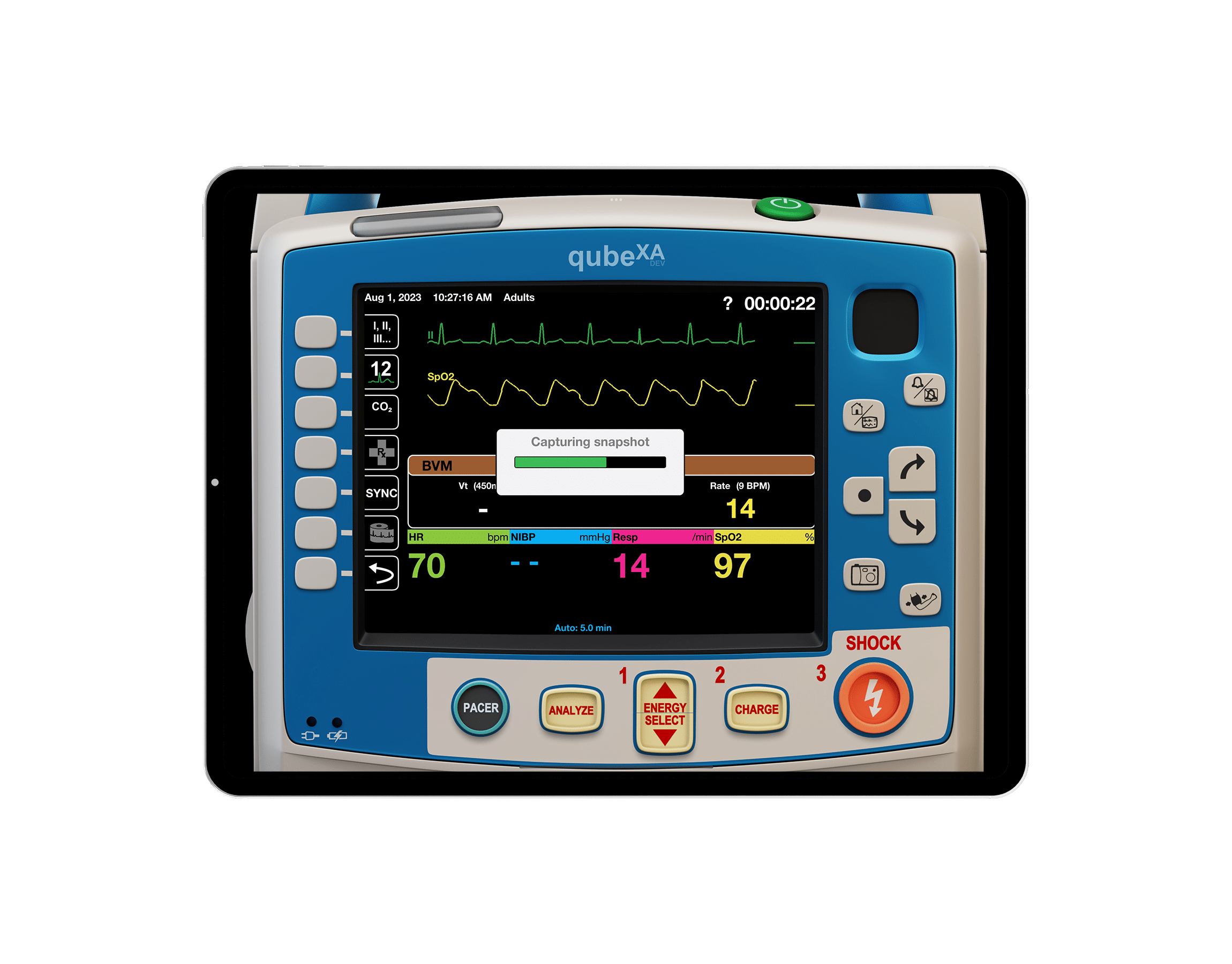 Screenshot-Funktion auf dem EKG-Patientensimulator von Skillqube