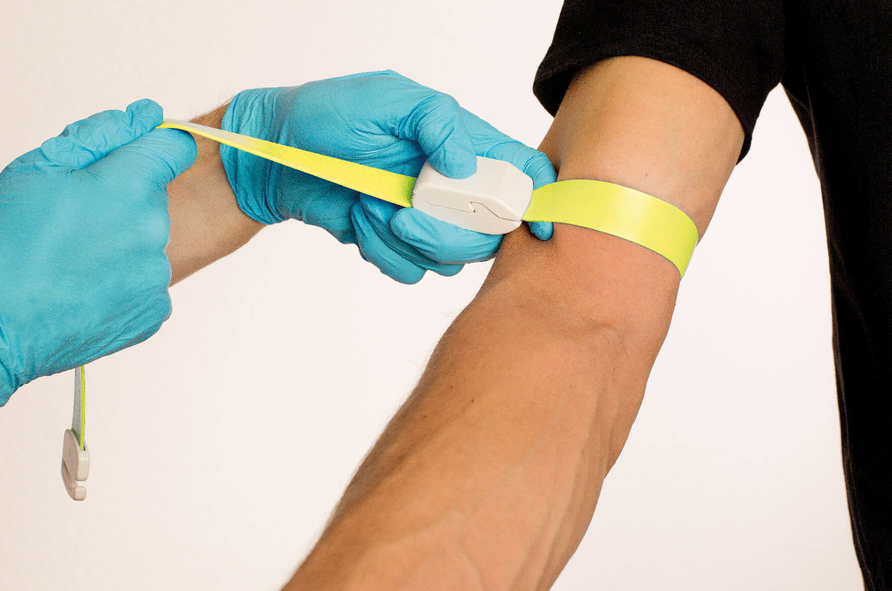 Gelbes Band Anwendung_am_Arm Anwendung von MeVes an Arm eines Patienten.